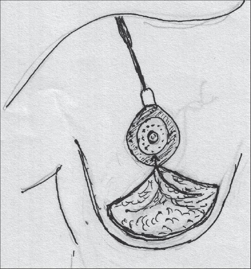 Diagram 37