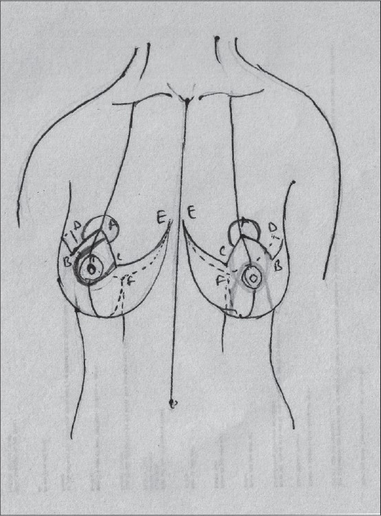 Diagram 25