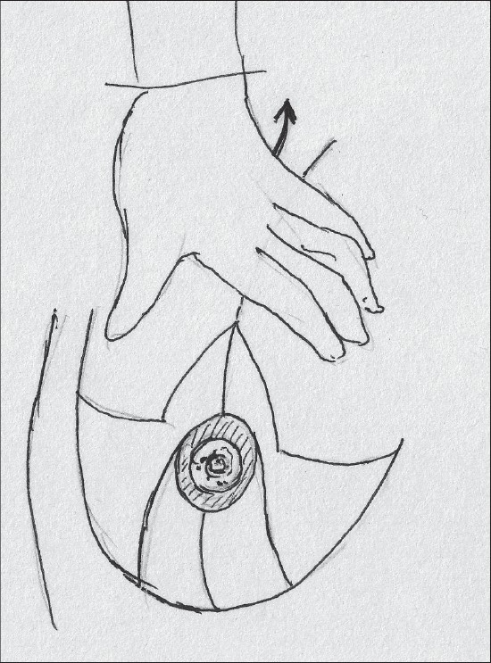 Diagram 18