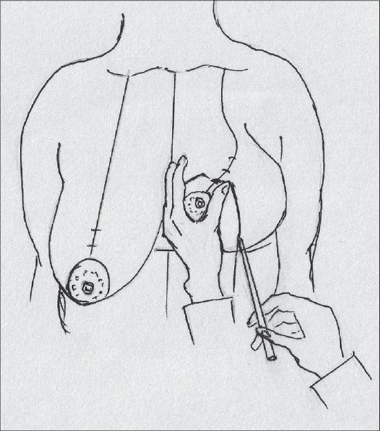 Diagram 31