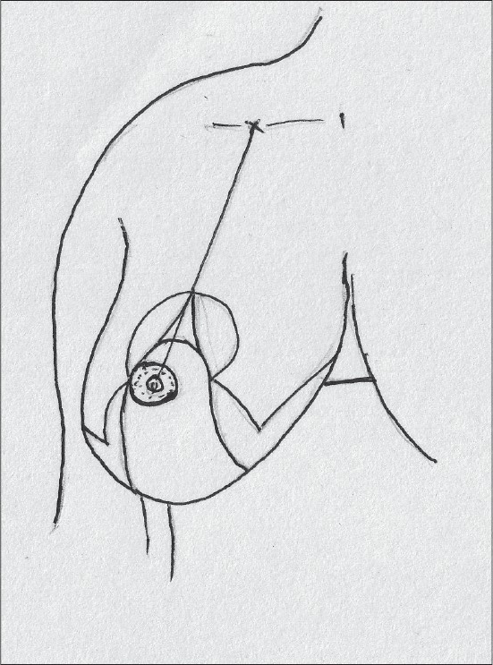 Diagram 34