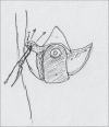 Diagram 21