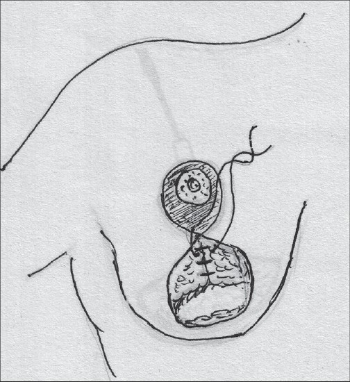 Diagram 38