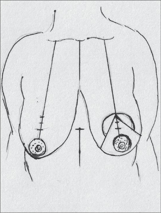 Diagram 29