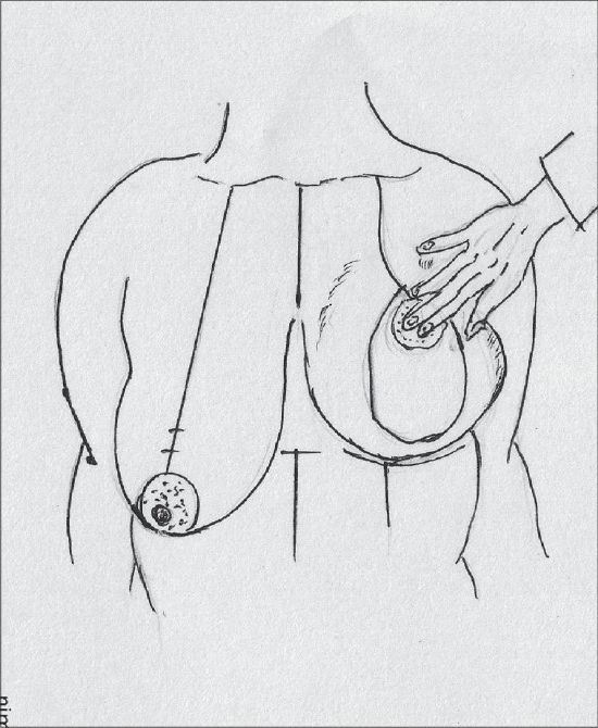 Diagram 33