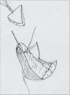 Diagram 22