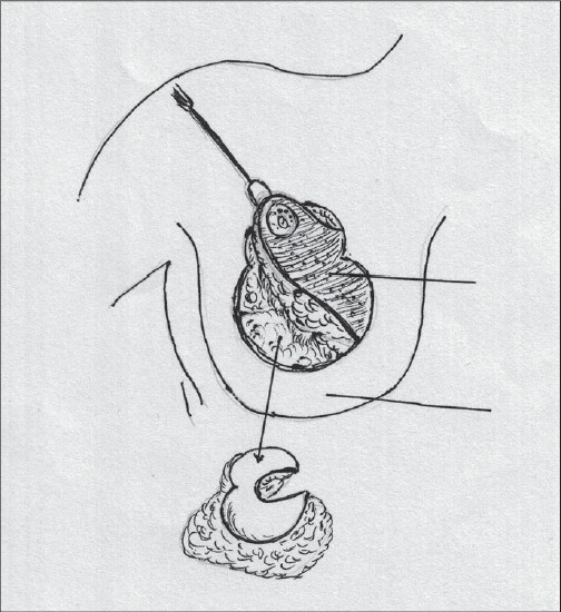 Diagram 36