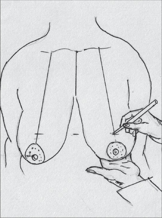 Diagram 11
