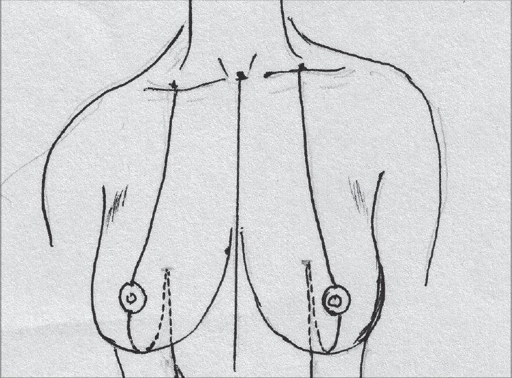Diagram 9