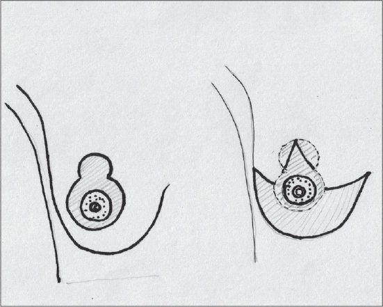 Diagram 6