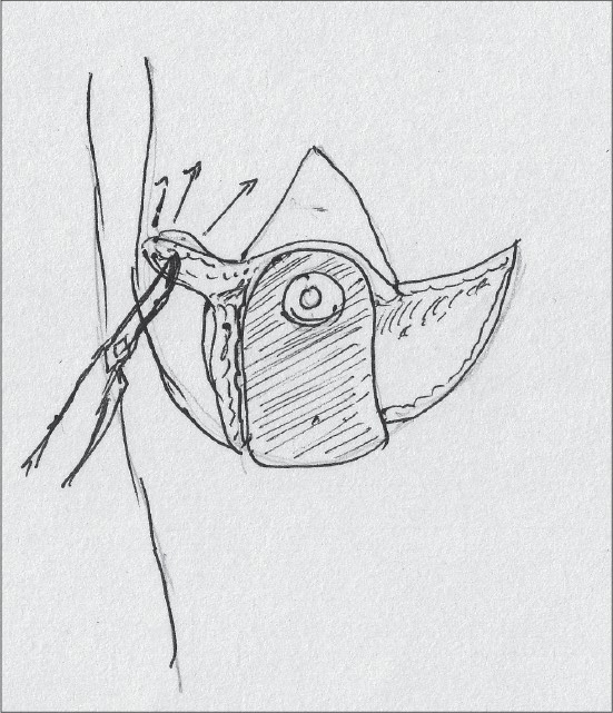 Diagram 21