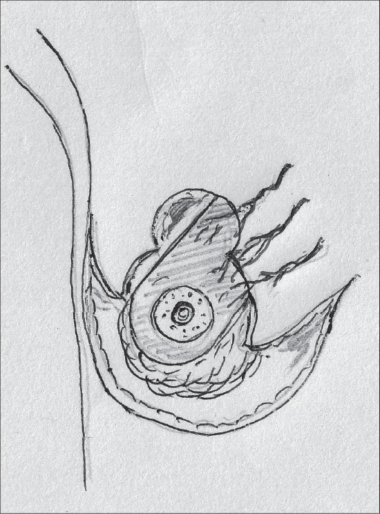 Diagram 5