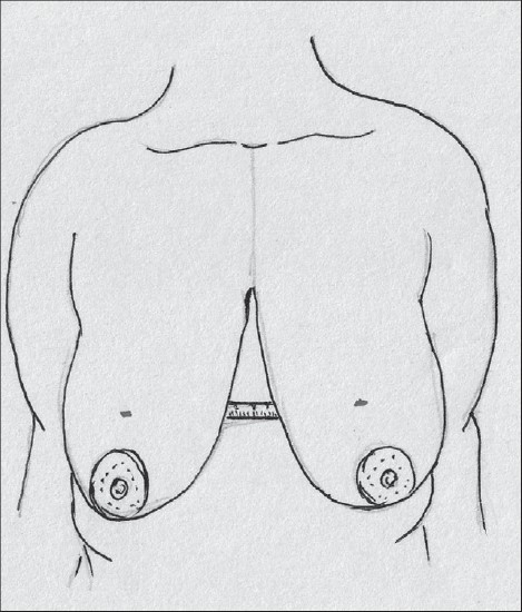 Diagram 10