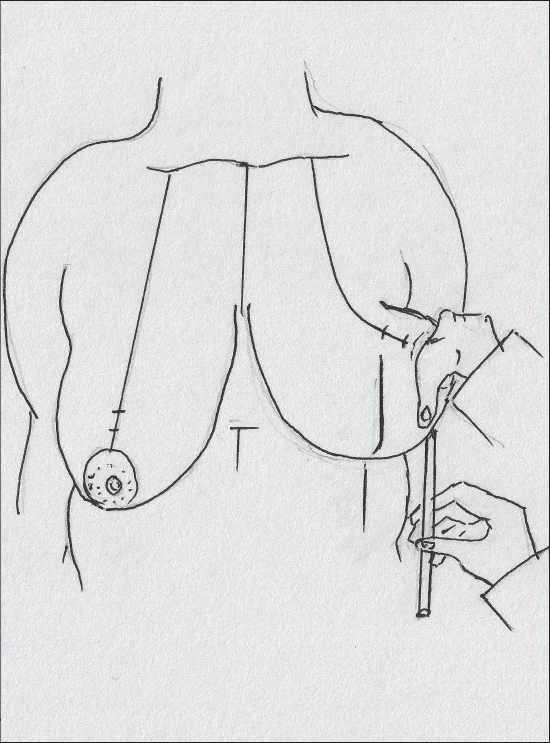 Diagram 32