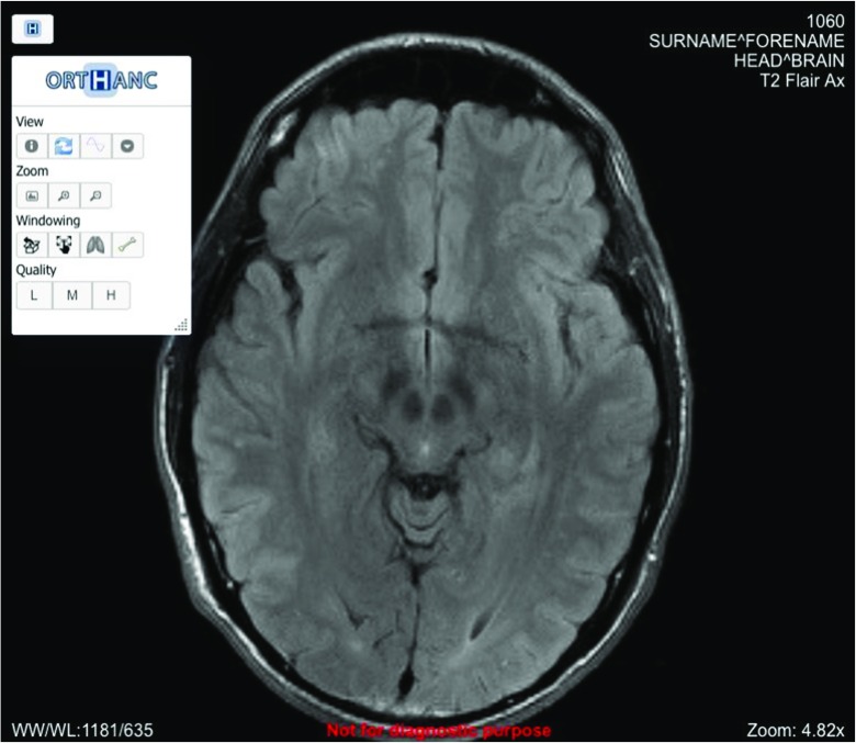 The Orthanc Ecosystem for Medical Imaging - PMC