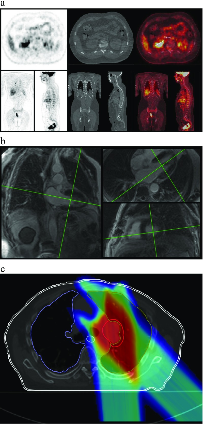 The Orthanc Ecosystem for Medical Imaging - PMC