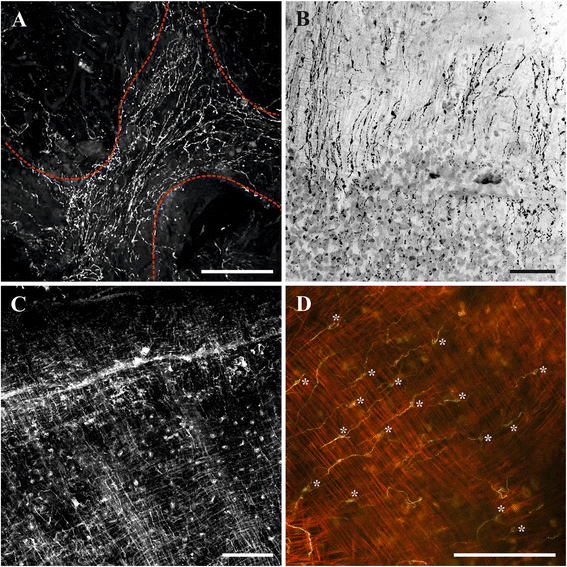 Fig. 13