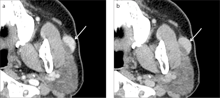 Figure 3. a, b