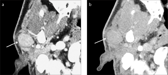 Figure 4. a, b