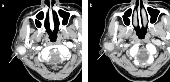 Figure 2. a, b