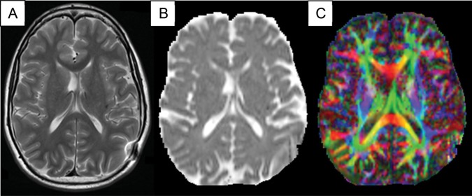 Fig. 2.