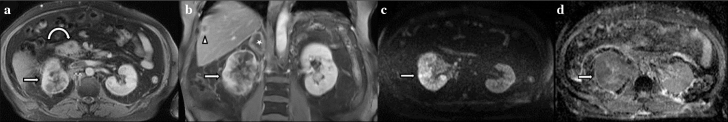 Figure 2. a–d.