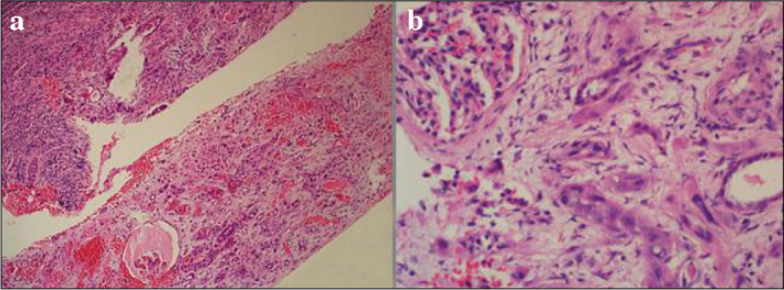 Figure 3. a, b.