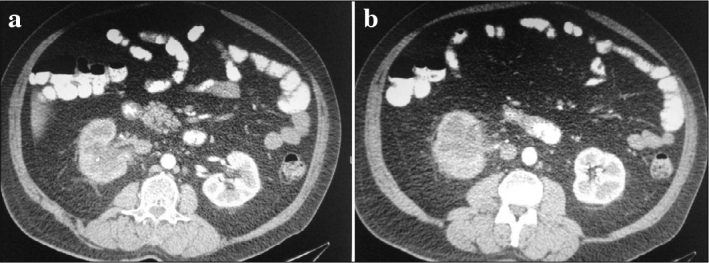 Figure 1. a, b.