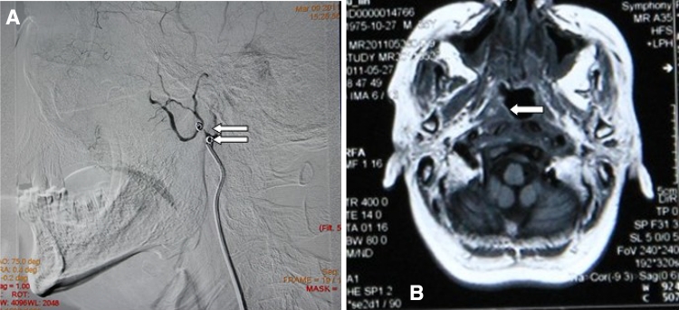 Fig. 2