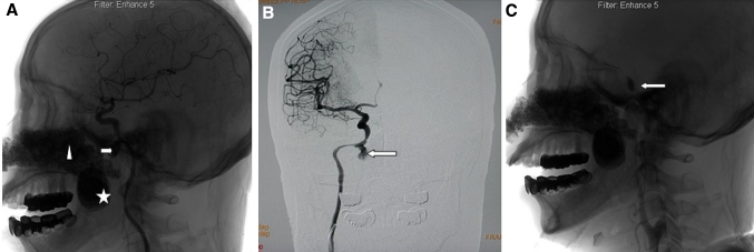 Fig. 1