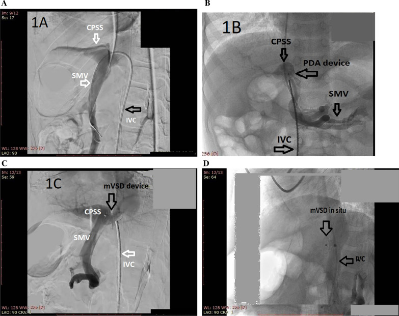 Fig. 2