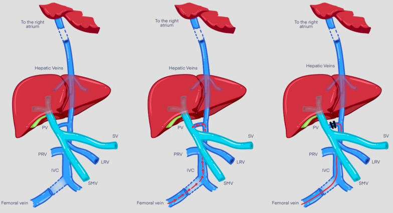 Fig. 3