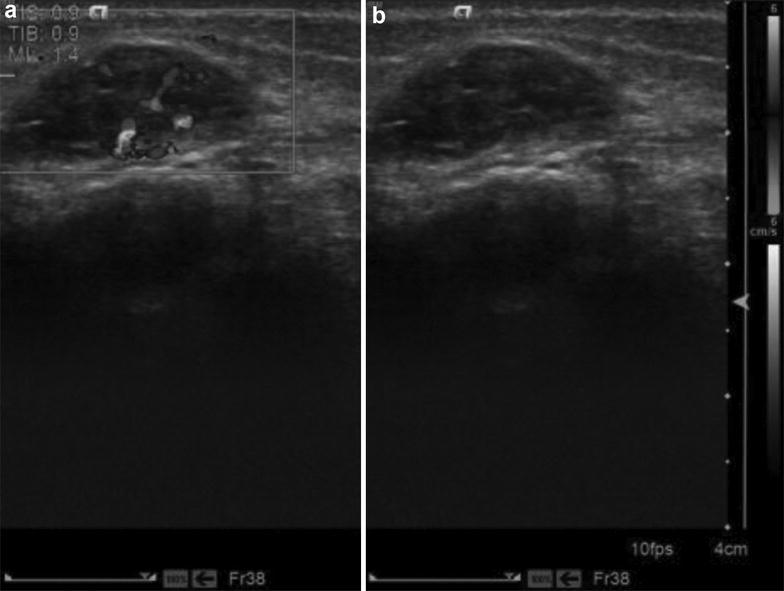 Fig. 2