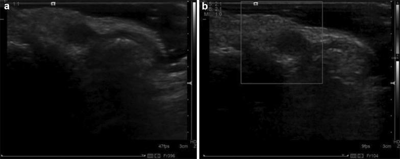 Fig. 3