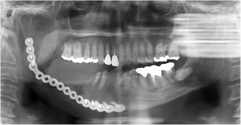 Fig. 8