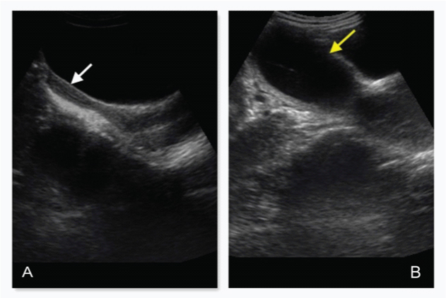 [Table/Fig-1A,B]: