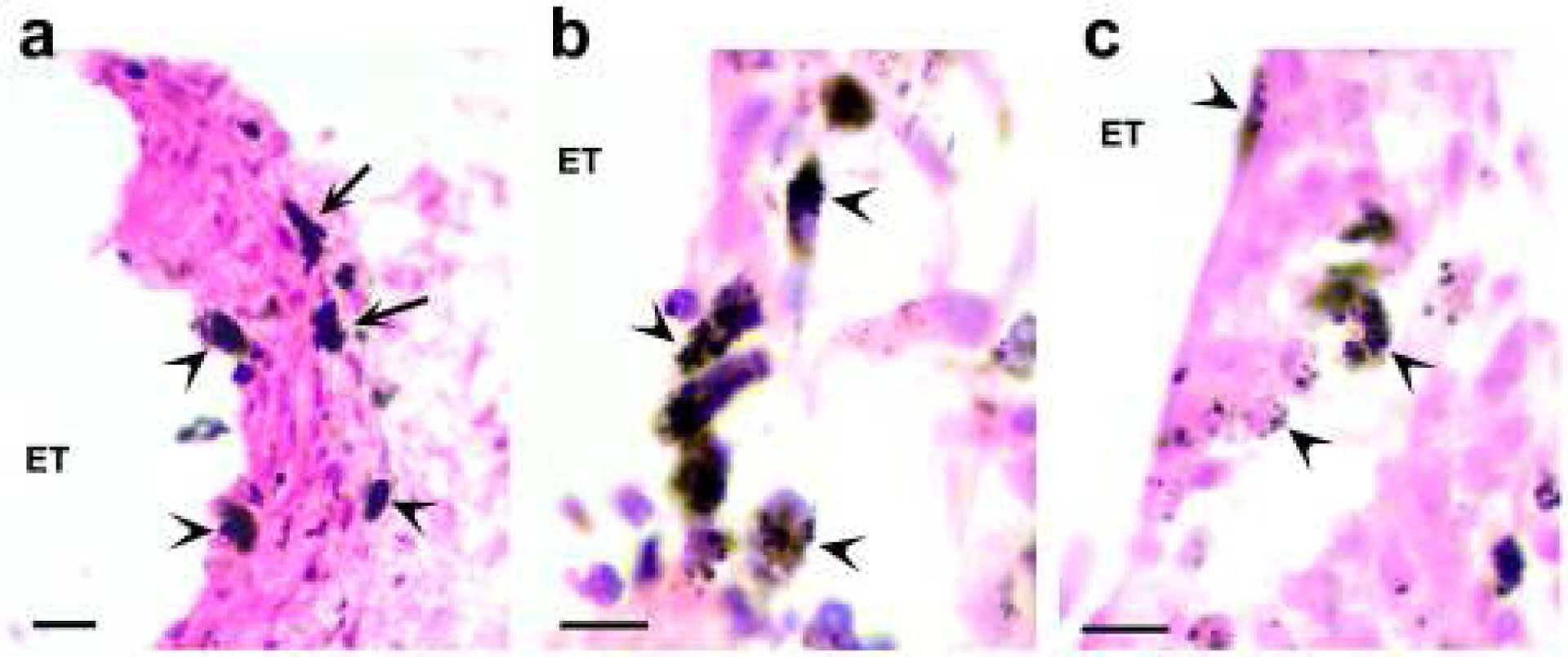 Figure 14.