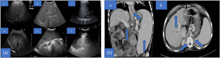 FIGURE 3