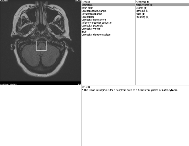 Fig. 13