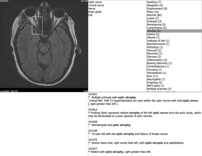 Fig. 12