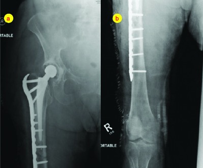 Figure 4a & 4b