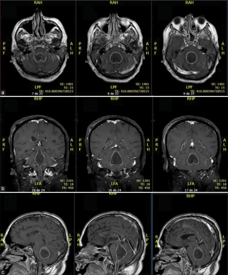 Figure 2: