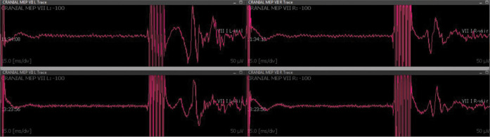 Figure 3: