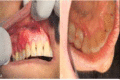 Fig1