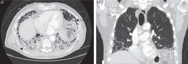 FIGURE 2