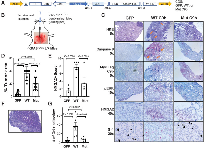 Figure 6. C9b cooperates with KRAS activation driving lung tumorigenesis. KRASG12D L/+ mice with intratracheal injection (B) of lentiviral particles containing GFP-, WT-, or Mut C9b-Cre(T2a)Luc (A) developed lung tumors (C) at 32 weeks post injection. IHC staining (C) with indicated antibodies shows the expression of Myc-tagged WT or mutant C9b, ERK activation (pERK), and HMGA2 in tumors and the presence of Gr1+ cells in the lung (black arrowheads). Orange arrows point to the clusters of immune cells observed. The percent replacement of normal lung parenchyma by tumor cells based on H&E and pERK signal (n = 12 for GFP, 10 for WT C9b, and 11 for Mut C9b, D), the HMGA2 positivity score (E), and the number of Gr1+ cells per view (20X magnification, G) (n = 4 for GFP, 6 for WT C9b and Mut C9b, average of 3 views per mouse for E and G) in each group are shown. F, Metastasis observed in the liver (H&E, 10x magnification) in a mouse with WT C9b expression. Data in D, E and G are means ± SEM combined from 2 independent intratracheal injection experiments. Adjusted P values are determined by ANOVA Tukey multiple comparison test.