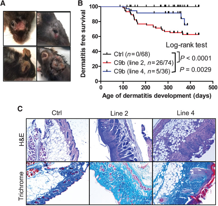 Figure 4. C9b mice develop severe skin dermatitis on the face and the back skin requiring euthanasia (A). B, Kaplan–Meier dermatitis-free survival curves show early onset of dermatitis in line 2 (n = 74) and line 4 mice (n = 36) compared with control (n = 68, P value: Log-rank test). C, H&E and trichrome staining of skins show the significantly thickened dermal area with increased collagen (blue in trichrome) in dermatitis lesions of C9b mice.