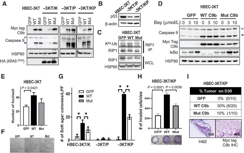 Figure 1. C9b activates NF-κB in HBEC-3KT cells and cooperates with KRAS activation and p53 loss driving AIG and invasion in vitro and tumor growth in vivo. A–D, Western blot analyses with indicated antibodies of HBEC-3KT, -3KT/K (KRASG12V), -3KT/P (shTP53), and -3KT/KP cells expressing GFP, WT, or AT/GG mutant (Mut) C9b (with a Myc-tag). C, RIP1 immunoprecipitation (IP) followed by immunoblotting with K63-Ub antibody shows increased RIP1 K63-Ub by WT C9b in HBEC-3KT cells (in growth supplement free media). In D, HBEC-3KT cells were treated with 0, 3, 10 μmol/L Bay 11–7082 for 15 hours. WCL, whole-cell lysates. The empty and filled triangles denote C9a and C9b proteins, respectively. E, Clonogenic assays of parental HBEC-3KT cells expressing GFP, WT, or Mut C9b. The graph shows numbers of clonal foci per well on D10. F, Bright field images (10x) of HBEC-3KT cells expressing GFP, WT, or Mut C9b grown in soft agar on D45. G, Number of colonies per low power field (LPF) view grown in soft agar on D45 (*, P ≤ 0.0002). H, Number of invaded HBEC-3KT/KP cells expressing GFP, WT, or Mut C9b through Matrigel at 22 hours per LPF view. I, SCID Tumor take rate of HBEC-3KT/KP cells expressing GFP, WT, or Mut C9b on day 30 postimplantation (top) and H&E, Myc-tag, and c-Myc IHC images (bottom). Data are means ± SD; n = 3 each. Adjusted P values are determined by ANOVA Tukey multiple comparison test.