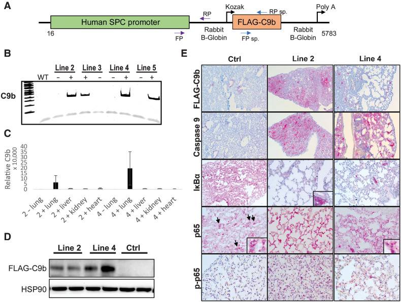 Figure 2. The SPC-driven C9b expression in mouse lung epithelium activates NF-κB pathway. A, A schematic diagram of a C9b transgene construct driven by human SPC promoter. Among the C9b transgene positive founder lines (B, PCR), line 2 and 4 C9b+ mice showed high levels of C9b transgene expression in lungs both for mRNA (C, real time rt-PCR, relative ratio of C9b/GAPDH) and protein (D, Western blot). E, Representative images of IHC staining with indicated antibodies (10x). Note a Flag-tagged C9b expression in lung epithelium, a decreased level of IκBα and an increased level of p-p65 in line 2 and line 4 mice compared with control mice. Insets (40x) in p65 images show the exclusion of p65 from nuclei in control but not in C9b mice. Inset in IκBa shows its strong positivity in immune aggregates.