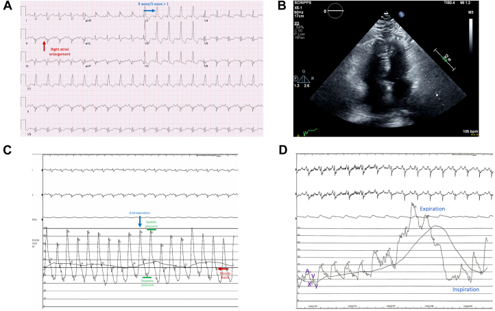 Figure 1